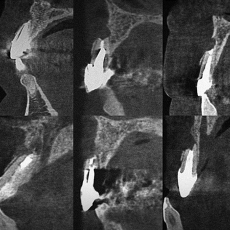 Endodontics 2025 v15n1