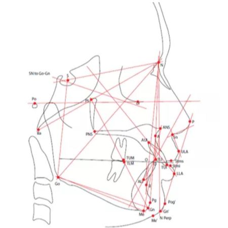 Reproducibility of linear and angular cephalometric measurements obtained by an artificial-intelligence assisted software (WebCeph) in comparison with digital software (AutoCEPH) and manual tracing method