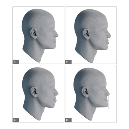 Análisis del perfil facial: propuesta de clasificación labio-rostro