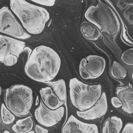 Effect of 1.2% simvastatin gel on the osteogenic activity of periodontal ligament mesenchymal stem cells