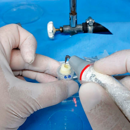 Ativação ultrassônica suplementar dos terços cervical e médio do canal radicular: efeito sobre a carga microbiana intracanal e a extrusão apical em réplicas radiculares impressas em 3D