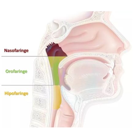 Obstructive sleep apnea: a review for the orthodontist