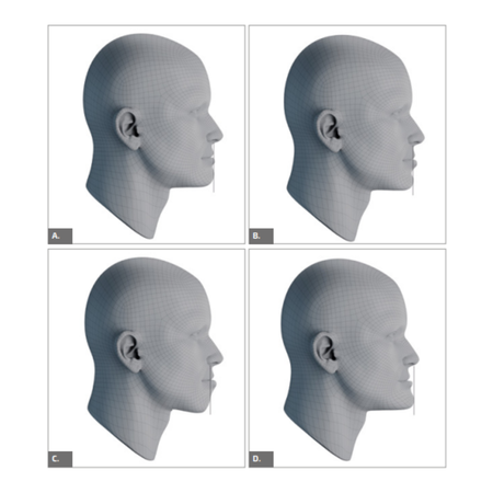 Análise do perfil facial: proposta de classificação lábio-face