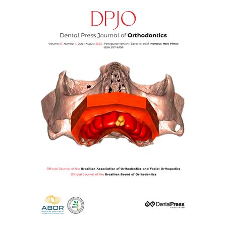 Análise da distribuição das tensões iniciais no osso palatino ao redor de implantes em Ortodontia Lingual, nos sistemas de implante palatino unitário ou duplo: um estudo de elementos finitos