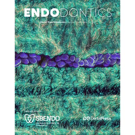 The use of guided Endodontics in the treatment of calcified canals: a literature review