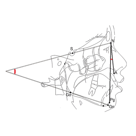 Association between mouth opening pattern and facial skeletal pattern: a retrospective analysis