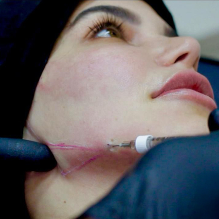 Impacto da harmonização facial na carreira de uma modelo: relato de caso