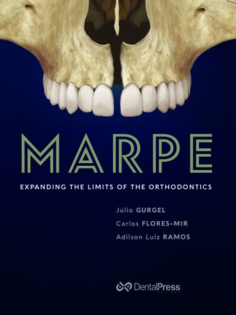 MARPE - Expanding The Limits of Orthodontics - The first edition of this book had its origin in deepening the
content of my conference on MARPE, which I held at the
21st Brazilian Congress of Orthodontics (Sociedade Paulista
de Ortodontia). At the end of this conference, my friend
Laurindo Furquim invited me to write a book on the subject,
using the same didactics used in the conference. After
accepting this challenge, I tried to develop a roadmap based
on the various concepts about MARPE shared with my
mentor, Professor Young-Chel Park. With the fundamental
help and high scientific feedback of several friends, I was
able to transcribe the bases for the diagnosis, planning and
treatment of transverse maxillary discrepancies.
Since this was the only book on the subject available so
far, there was great interest from colleagues from various
continents. To help these professionals, I decided to
implement the translation of the first edition. Again with the
support of Prof. Young-Chel Park and mobilization of the
entire staff of the Dental Press publishers, I considered not
only translating, but also increasing the content. Therefore, I
invited the world exponents in this subject to help me in this
task. To my great satisfaction, my invitation was promptly
answered, giving me the impression that these experts
observed that this book provides an understanding of
different methods and practices on the subject.
This 2nd edition of the book MARPE: Expanding the Limits
of Orthodontics aims to offer a broad technical-scientific
content on maxillary expansion assisted by anchorage
with mini-implants. The responsibility of preparing this rich
material encouraged me to invite my friends Carlos Flores-
Mir and Adilson Ramos as co-authors, so that they could
expose ideas with more freedom and in the best manner.
The distribution of chapter themes, as well as the interaction
with the authors of those chapters, was the result of our
combined analysis for the greatest benefit of the reader.
The authors of this book, as well as the authors of chapters in
this book, understand that, between writing and completion
of the editorial process, new evidence has emerged about
mini-implant-anchored maxillary expanders.
Reading this book will allow the reader to achieve knowledge
about the evolution, foundations and mastery of this
innovative option for the treatment of transverse maxillary
discrepancies.