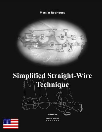Simplified Straight-Wire Technique - 