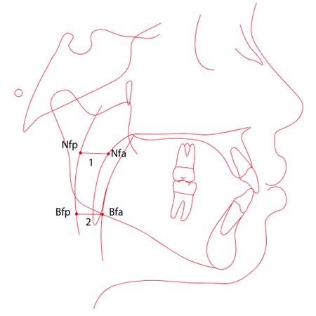 Comparative cephalometric study of the airways between different ethnic groups with normal occlusion