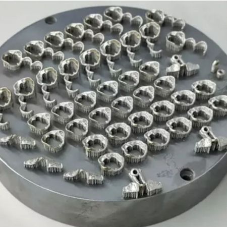 Metal-printed orthodontic appliances: Printed Orthodontics technique