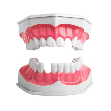 Manipulation of soft tissues as an alternative for alveolar preservation: case report