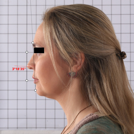 Avaliação da reprodutibilidade dos registros fotográficos do perfil facial realizados em duas diferentes posições de cabeça