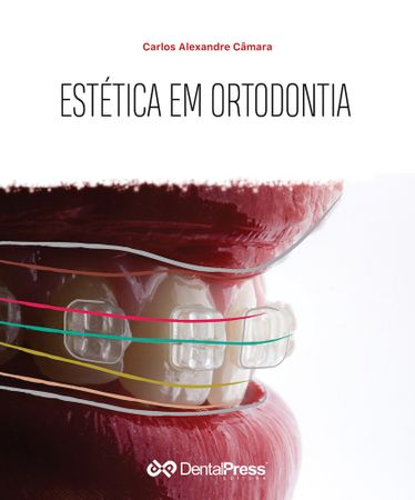 Estética em Ortodontia - 