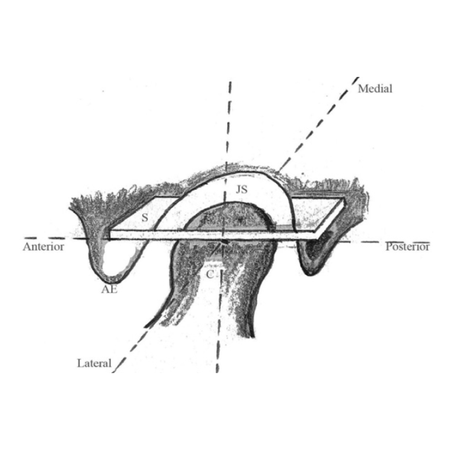 Three-dimensional volumetric changes in TMJ space following mandibular advancement surgery in skeletal Class II patients: a CBCT analysis