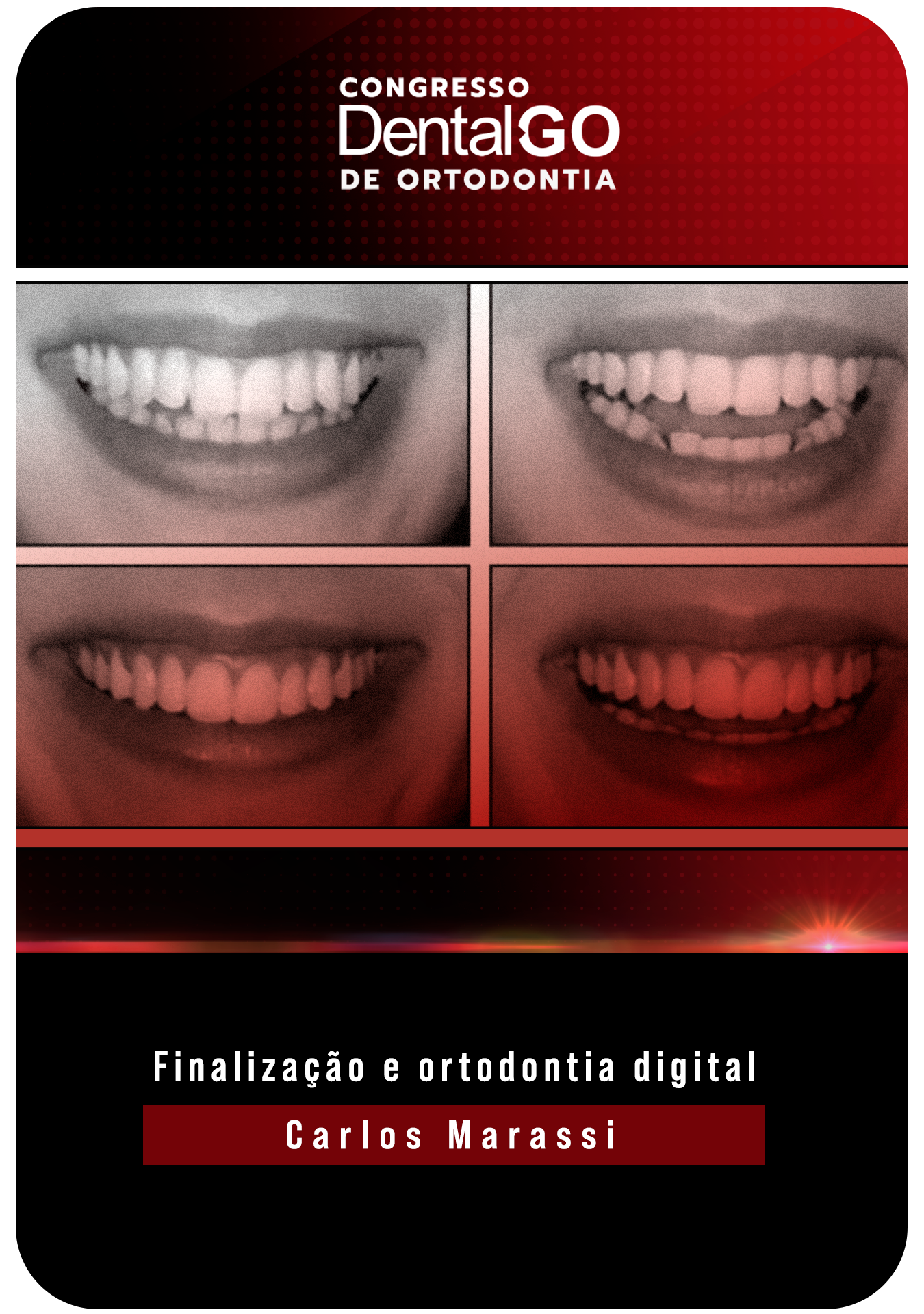 Carlo Marassi - Finalização e ortodontia digital
