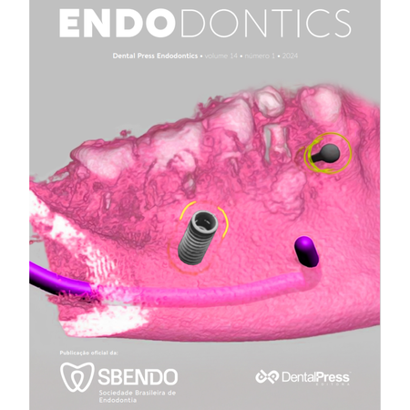 Does dentin-bonding agent prevent discoloration caused by antibiotic pastes used in regenerative endodontic procedures? A spectrophotometric analysis