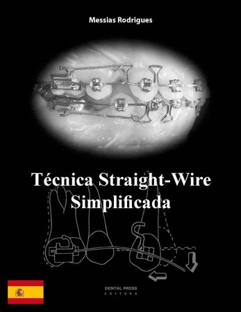 Técnica Straight-Wire Simplificada - 