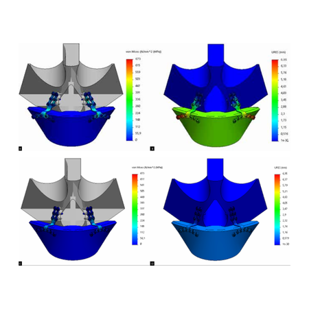 Finite element analysis of locking vs. Non-locking plates in Le Fort I osteotomy fixation