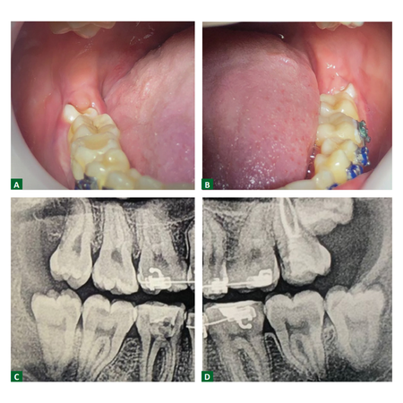 Periodontology 2024 v34n4