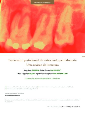 Tratamento periodontal de lesões endoperiodontais: Uma revisão de literatura