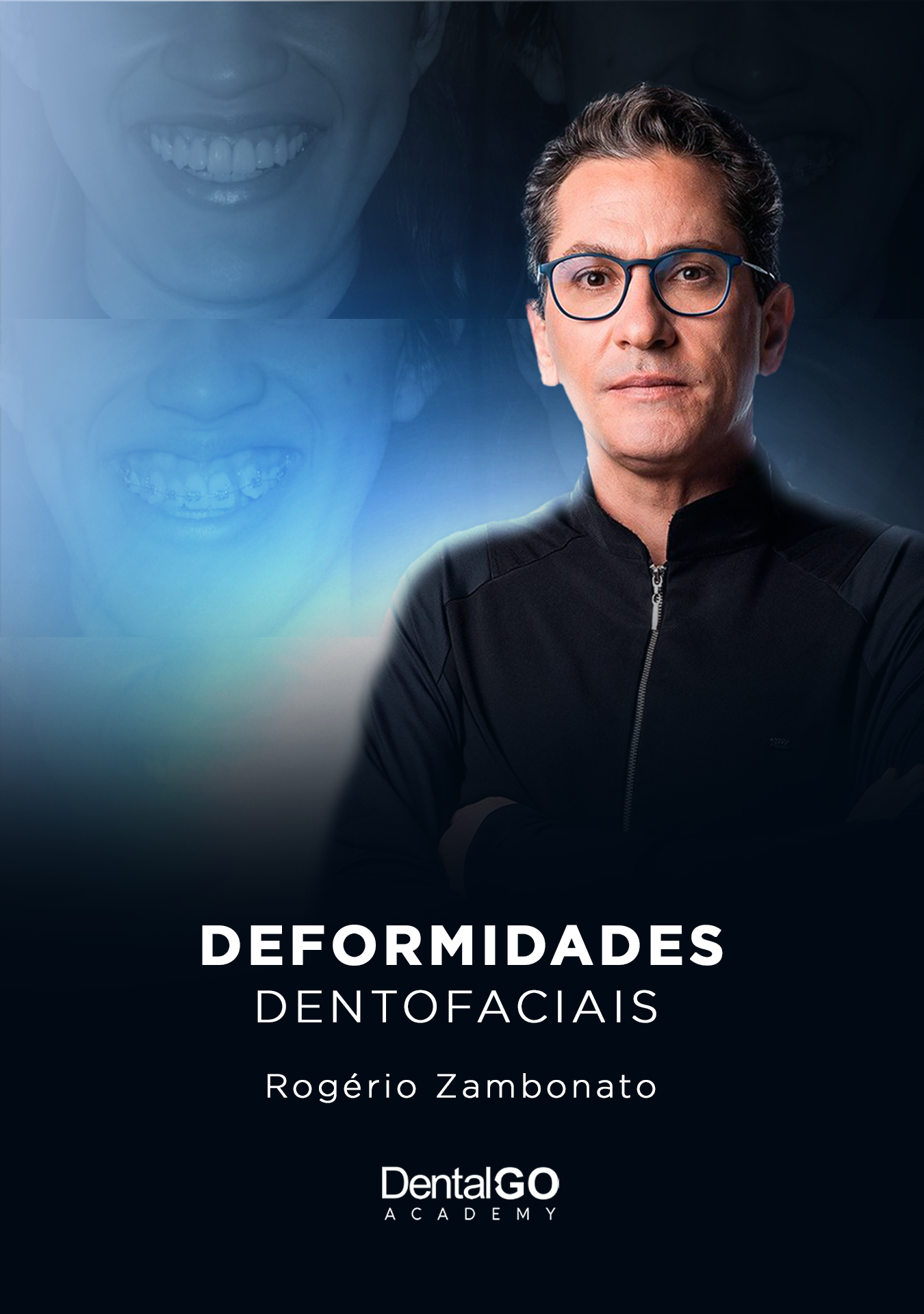 Deformidades Dentofaciais