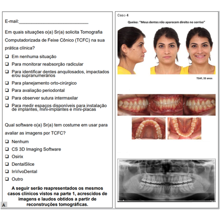 Impacto do diagnóstico tomográfico da cobertura óssea alveolar no planejamento ortodôntico: estudo transversal