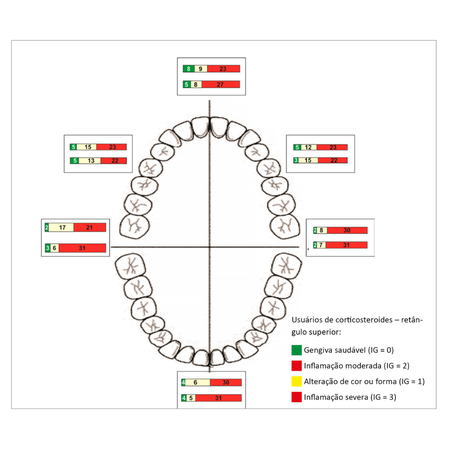 Periodontal evaluation of asthmatic adolescents taking inhaled steroids