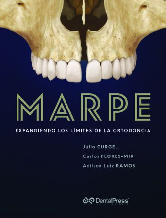 MARPE - Expandiendo los límites de la ortodoncia - 