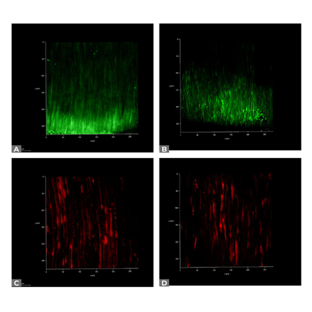 Ozonated water and tea tree essential oil as alternative irrigants in the eradication of multispecies biofilm