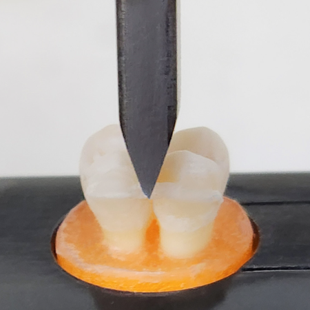 Contenções linguais inovadoras impressas em 3D: características da descolagem após envelhecimento artificial e ataque ácido