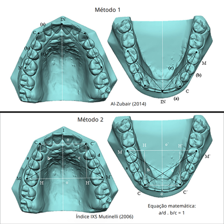 Fluctuating arch symmetry: a comparison of two methods of assessment - applicability and efficiency