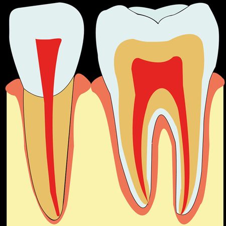 Root perforation treatment: a tutorial in slide presentation format