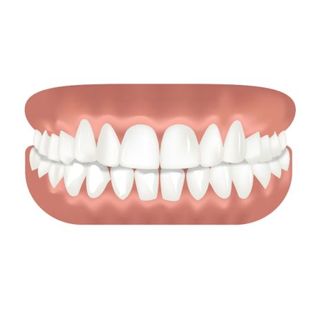 Prevalence of etiological factors associated with gingival smile: a clinical study