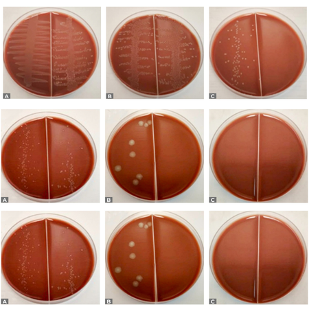 Eficácia antimicrobiana comparativa da N-acetilcisteína e do hidróxido de cálcio contra Enterococcus faecalis: estudo in vitro