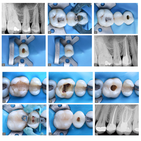 Endodontics 2024 v14n3