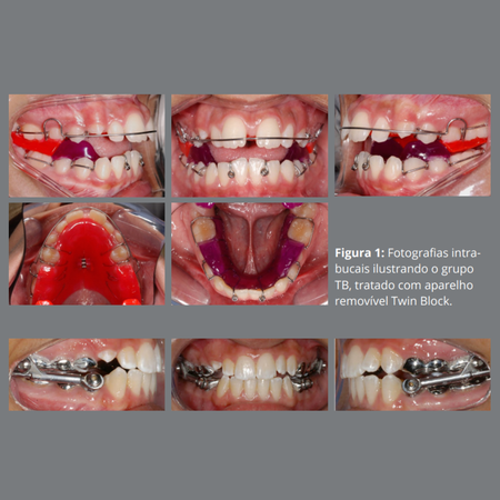 Facial soft tissue changes in adolescent patients treated with three different functional appliances: a randomized clinical trial