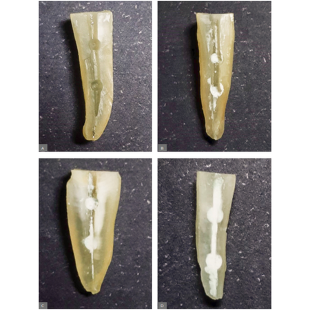 Influence of different ultrasonic inserts and vehicles associated with calcium hydroxide on intracanal medication remotion