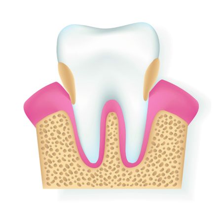 Interrelationship between metabolic syndrome and periodontitis: literature review and future perspectives