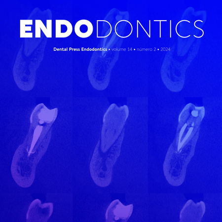 What is the best endodontic instrument on the market?