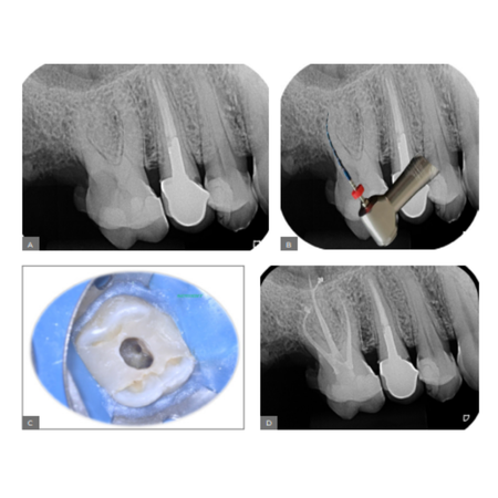 Endodontics 2024 v14n2