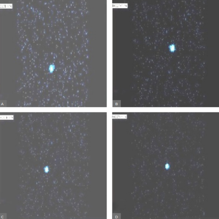 Effect of chlorhexidine on the sealing ability of ProRoot MTA and Endocem MTA as root-end filling materials: an in-vitro study