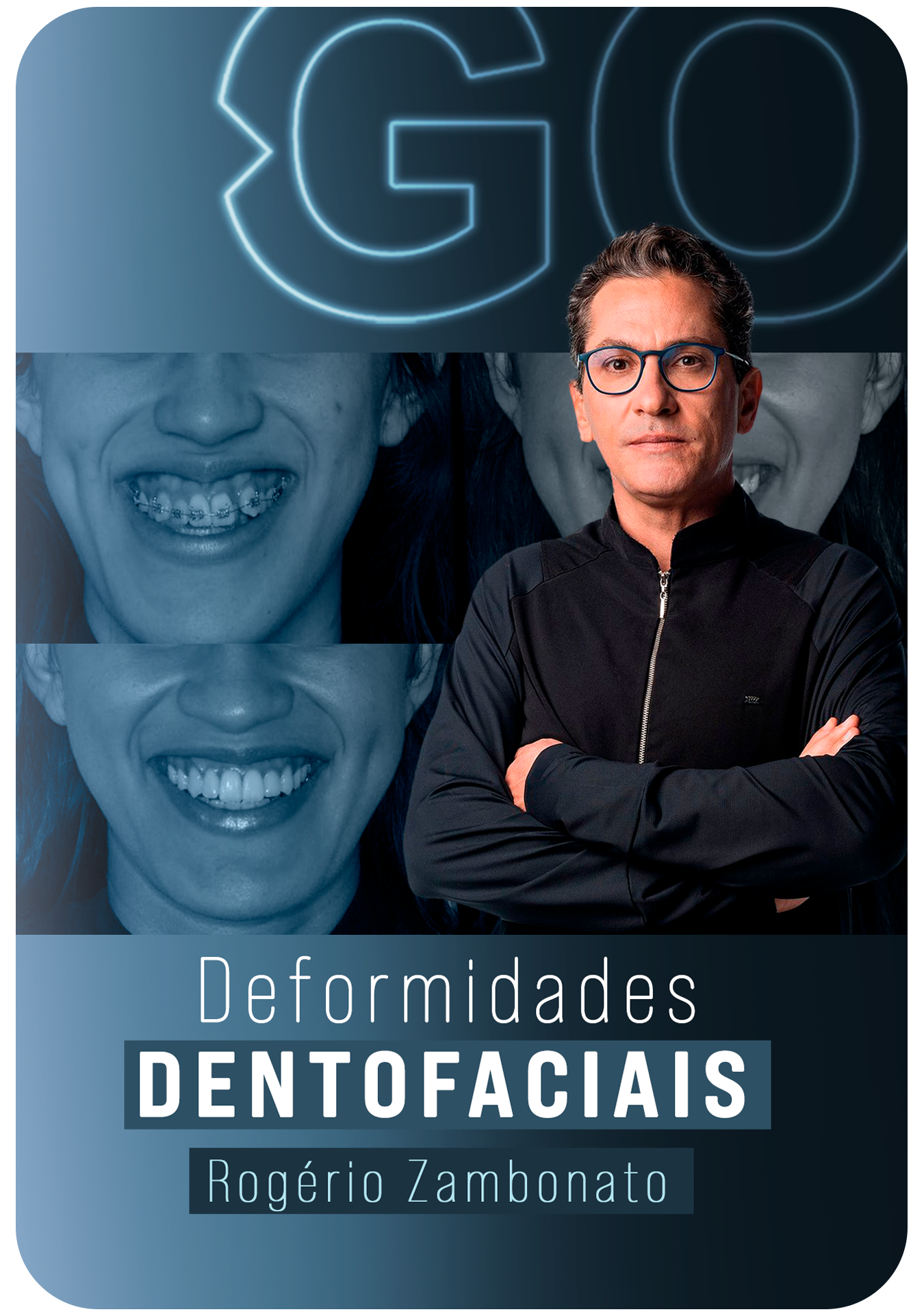 Deformidades Dentofaciais