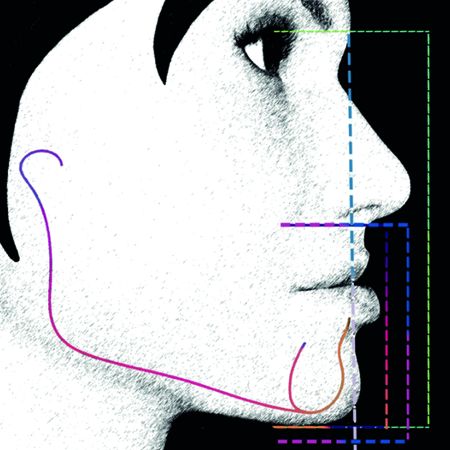 Tratamento ortodôntico não cirúrgico de pacientes com Face Curta: criando links entre o diagnóstico e as soluções clínicas