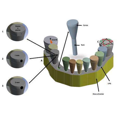 Como o formato da arcada e o tamanho do contato interproximal afetam os deslocamentos e as rotações 3D dos dentes: uma análise de elementos finitos