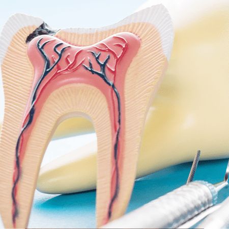 The impact of technology in Endodontics practice