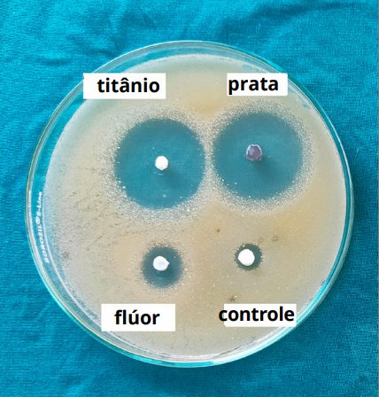 Avaliação das propriedades antibacterianas e da resistência ao cisalhamento de compósitos ortodônticos contendo nanopartículas de prata, nanopartículas de dióxido de titânio ou flúor: um estudo in vitro