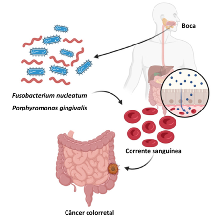 Medicina periodontal: a relação entre saúde periodontal e sistêmica