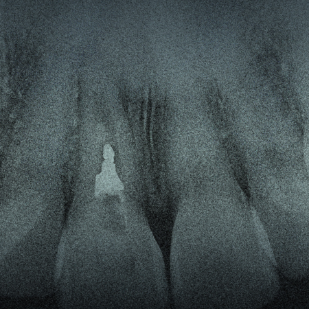 Endodontics 2024 v14n3