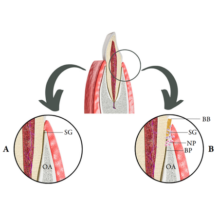 Mecanismos patogênicos da doença periodontal associada à insuficiência cardíaca: revisão da literatura